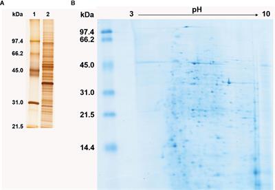 Immunoproteomics Reveals Pathogen’s Antigens Involved in Homo sapiens–Histoplasma capsulatum Interaction and Specific Linear B-Cell Epitopes in Histoplasmosis